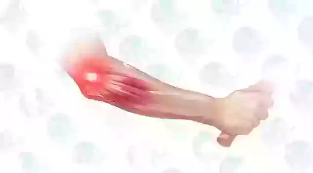 Tennis Elbow