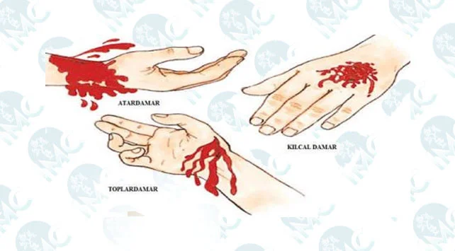 Damar Yaralanması