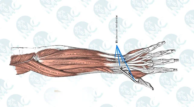 Tendon Kopmaları